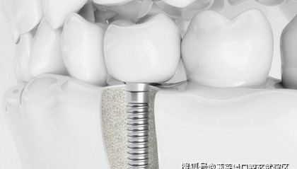 南京茀莱堡口腔热点资讯，新岁启新齿，口福自然来